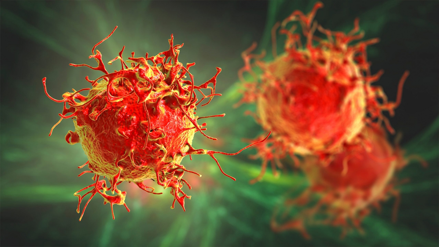 Cancer Patients Screening Using Immunity Nano Sensor